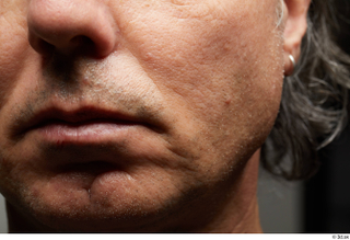  HD Face Skin Benito Romero cheek chin face lips mouth scar skin pores skin texture 0004.jpg